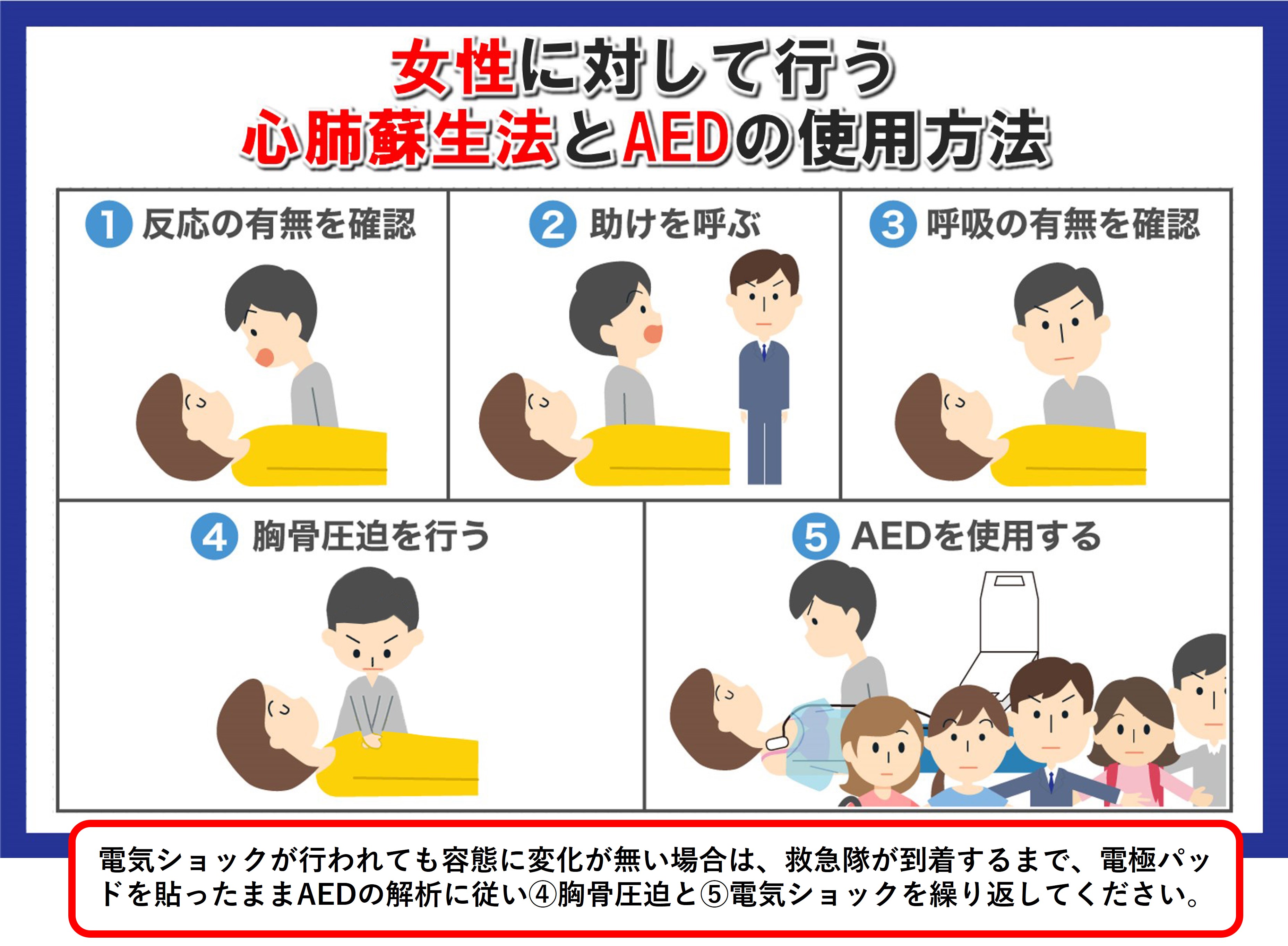 女性に対して行う心肺蘇生とAEDの使用方法