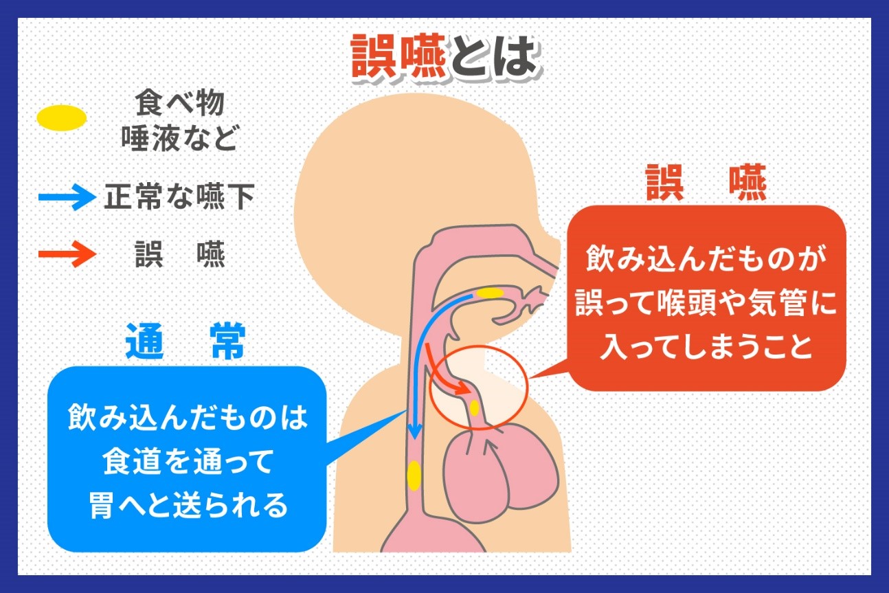 誤嚥を予防する