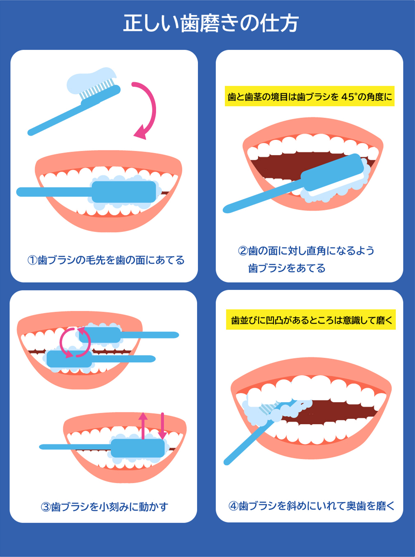 正しい歯磨きの仕方をイラスト付きで解説